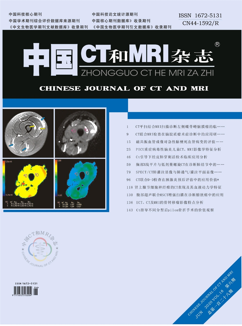中國CT和MRI雜志